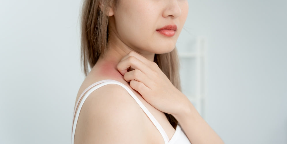 Dermatite seborroica: sintomi, cause e trattamenti