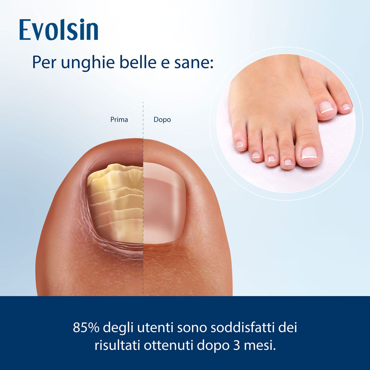 Evolsin Liquido Antimicotico per Unghie 10ml