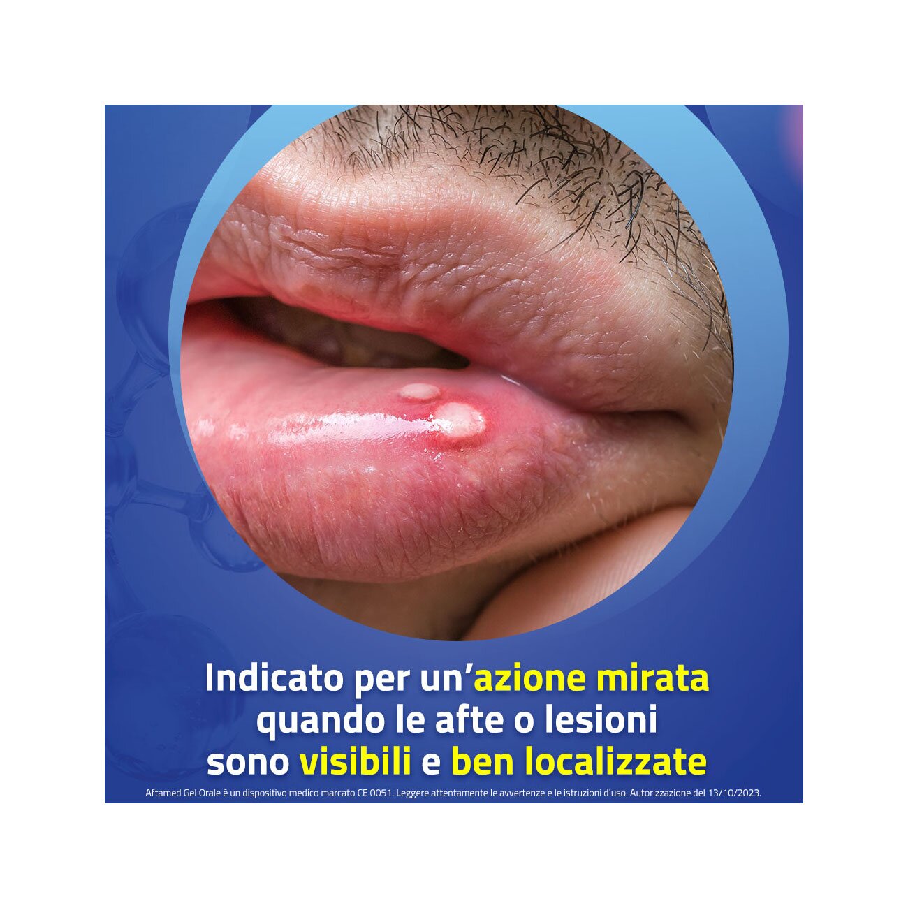 Aftamed gel orale 10ml